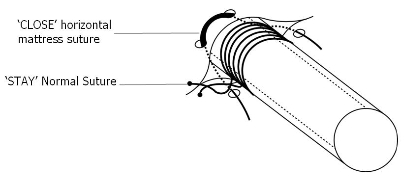 Figure 13 Stay and close sutures